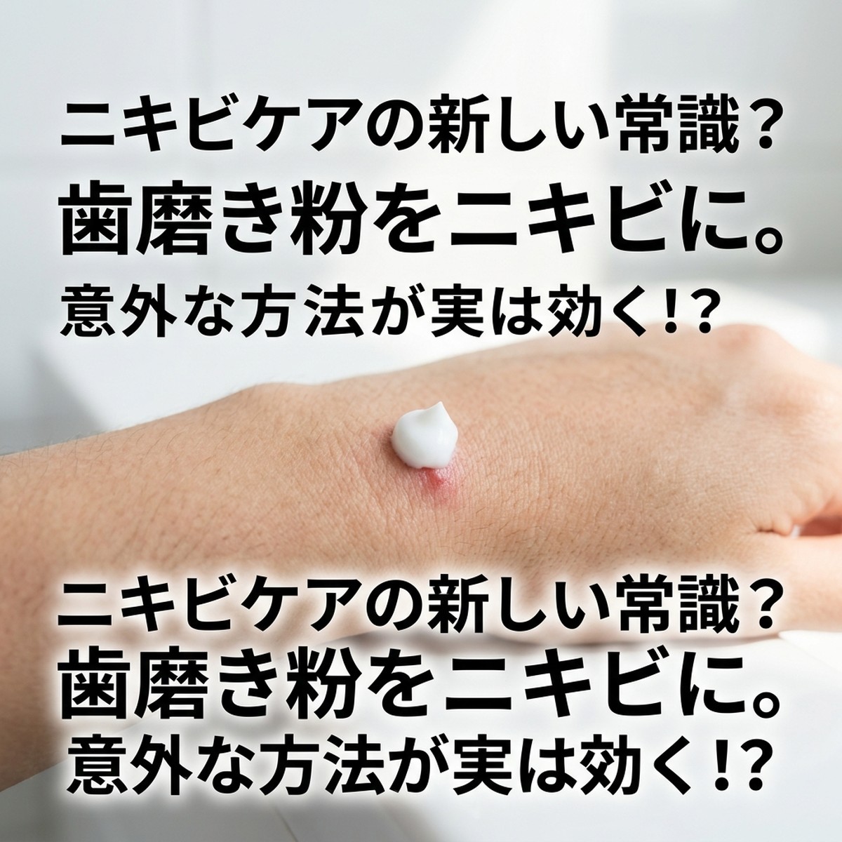 ニキビに歯磨き粉は効果的？その理由と正しい使い方を解説